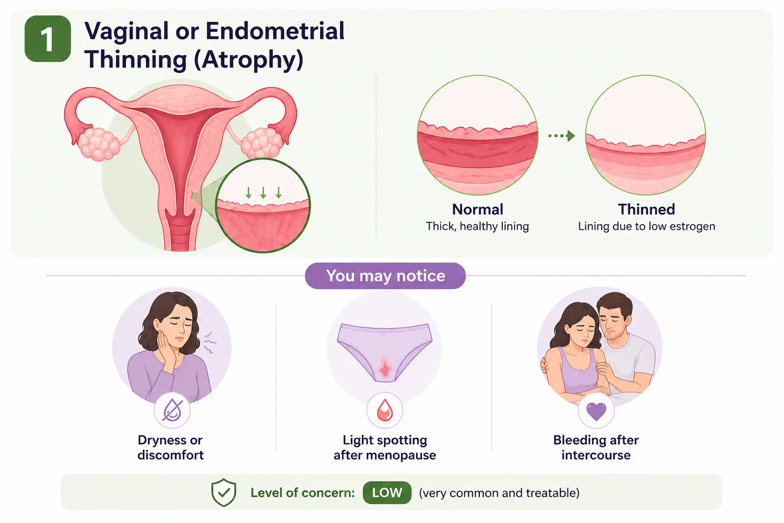 Infographic illustrating vaginal and endometrial thinning after menopause with symptoms like dryness, spotting, and bleeding after intercourse.