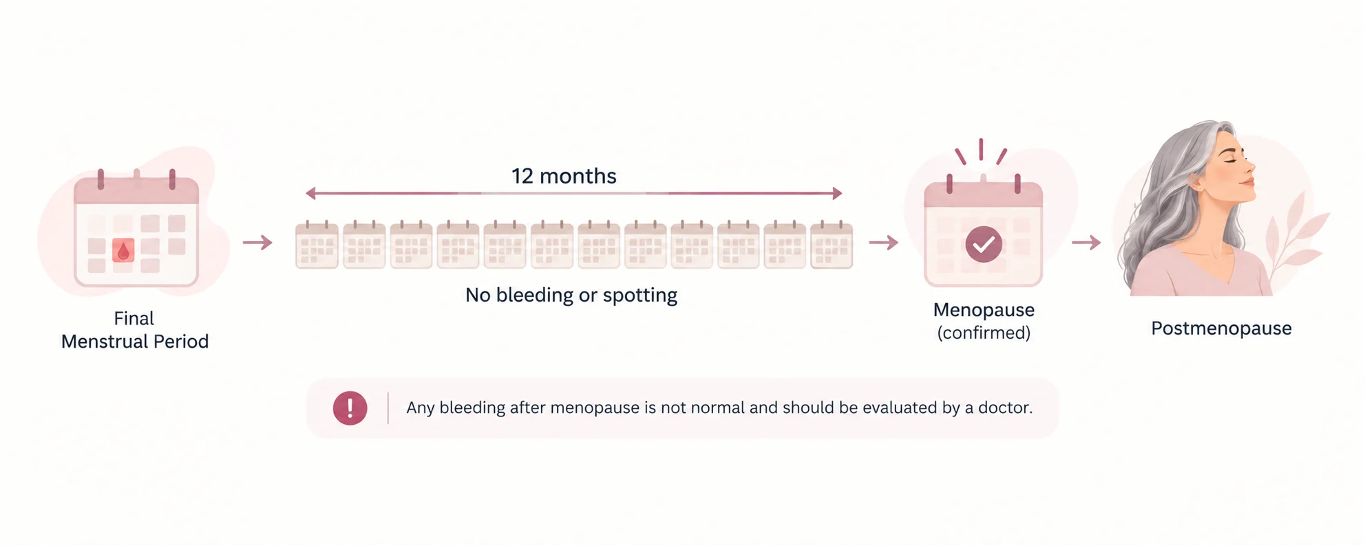 Calendar illustrating the final menstrual period and 12-month rule for retrospectively confirming menopause.